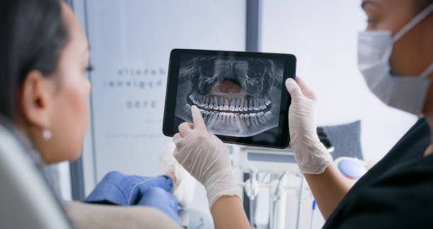 Licensed Tooth Extraction service in Bret Harte, CA - Smile Center Dentistry